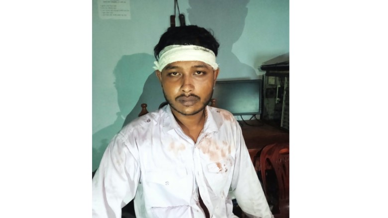 চারঘাটে যুবককে কুপিয়ে জখম, সাড়ে ৫ লাখ টাকা ছিনতাই ও বাড়িতে অগ্নিসংযোগের অভিযোগ...